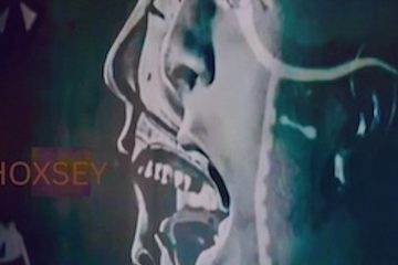Hoxsey — Hoxsey