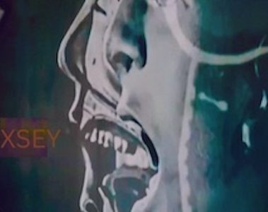 Hoxsey — Hoxsey